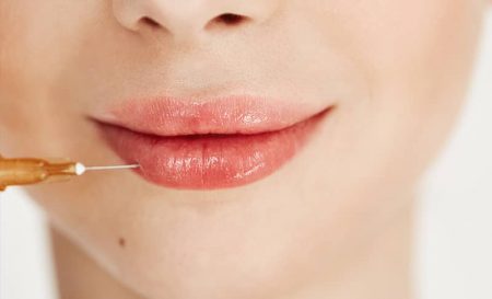 ¿Pensando en ponerte Ácido Hialurónico en los labios? Resolvemos tus dudas