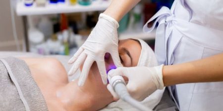 laser-rejuvenecimiento-facial